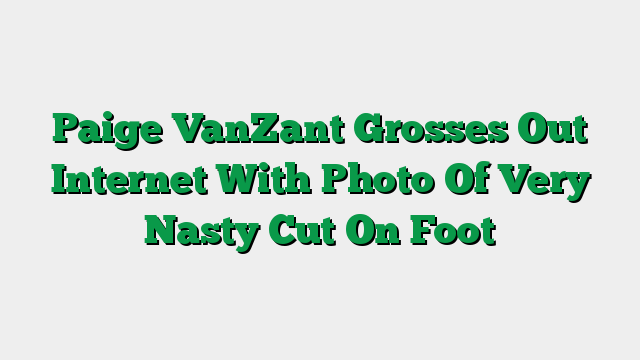 Paige VanZant Grosses Out Internet With Photo Of Very Nasty Cut On Foot